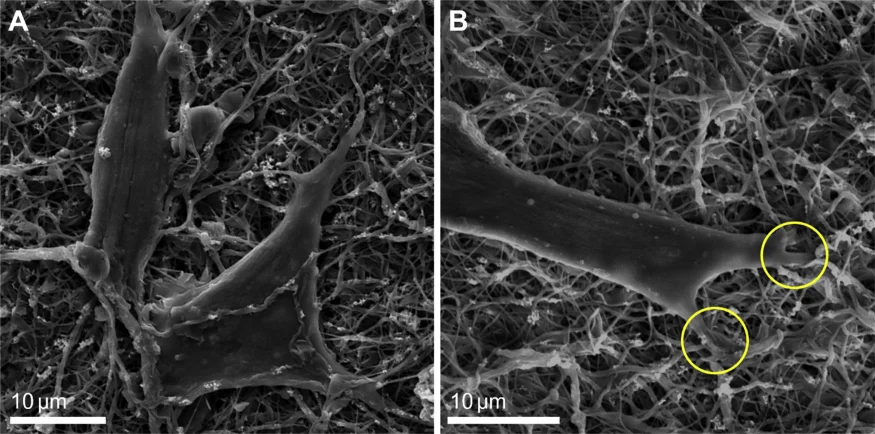 Saos-2 cells adhering to an electrospun bone scaffold membrane
