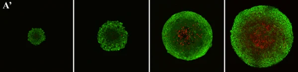 A look at 4 sizes of tissue spheroids undergoing micro-mechanical testing