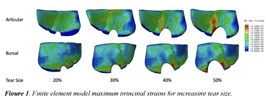 Finite element model maximum principal strains for increasing tear size