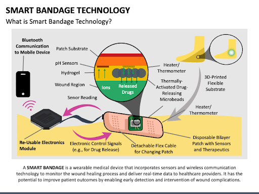 Smart Bandage uses sensors and wireless communication technology