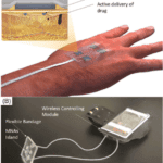 Wear Device Smart Bandage