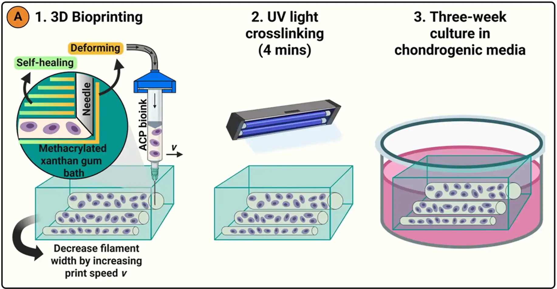 Schematic showing embedded 3D bioprinting of a cell-only cartilage construct inside a methacrylated xanthan gum support bath, illustrating self-healing support behaviour, control of filament spacing through print speed, UV crosslinking, and subsequent culture in chondrogenic media.
