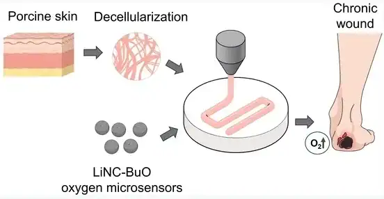 Oxygen-sensing 3D printed skin graft workflow using porcine skin extracellular matrix bioink (psECM) and embedded oxygen microsensors for chronic wound oxygen monitoring.