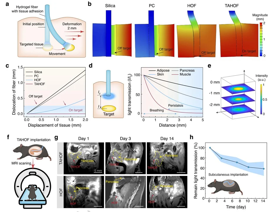 Simulation and MRI tracking of tissue-adhesive hydrogel optical fibres on dynamically moving pancreatic tissue.