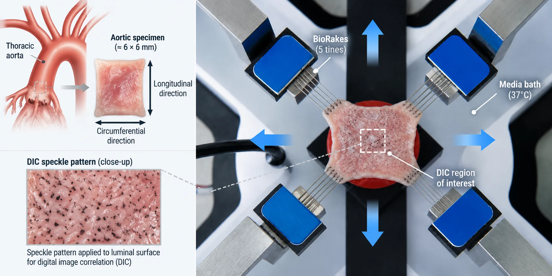 Aortic biaxial testing of thoracic aorta tissue in the circumferential and longitudinal directions.