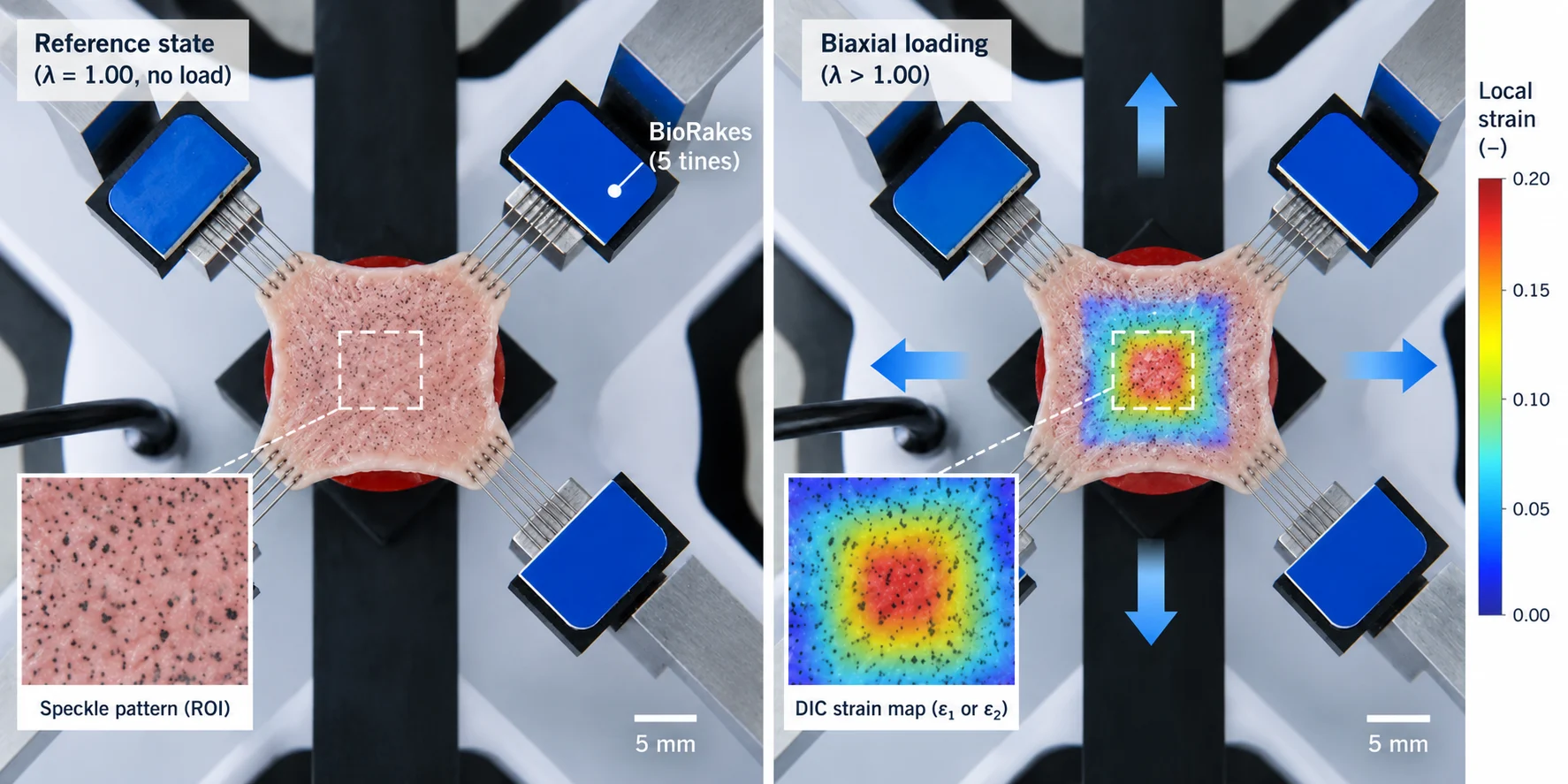 Digital image correlation measuring local strain in a speckled aortic tissue specimen during biaxial testing.